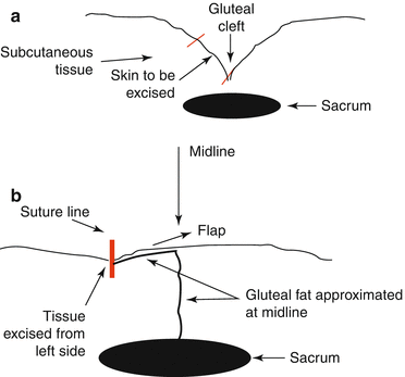 chiasmus diagram showing abba pattern