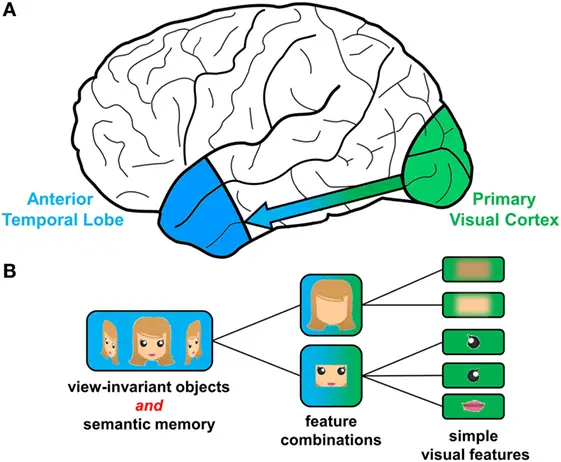 Diagram showing function of the temporal lobe