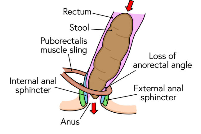 Physiology of defecation in the anarectal region